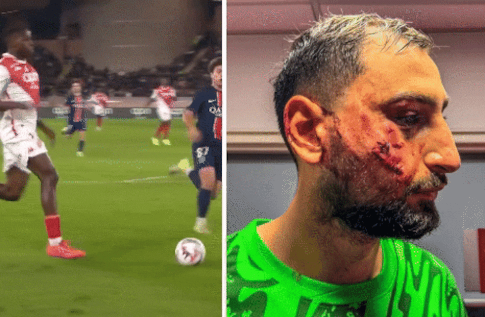 Los Andes | El arquero italiano Donnarumma recibió un escalofriante planchazo en la victoria del PSG sobre el Mónaco.