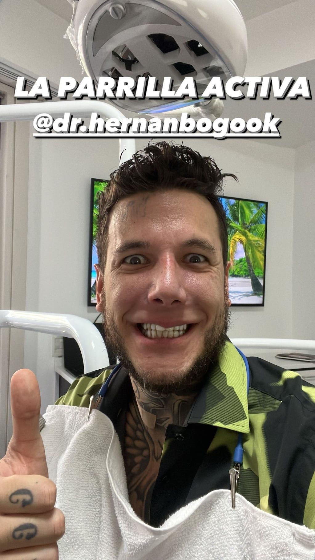 Alex Caniggia comparó su dentadura con la de L-Gante.