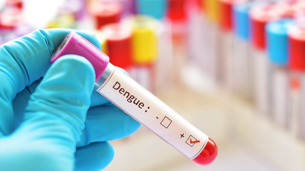 Dengue 