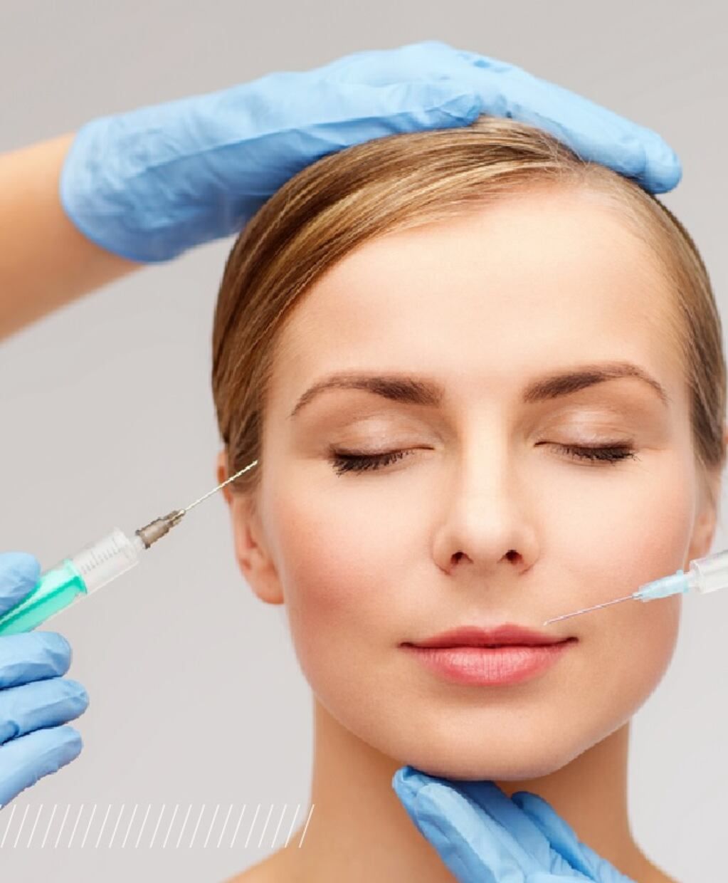 Mitos y verdades sobre botox y rellenos