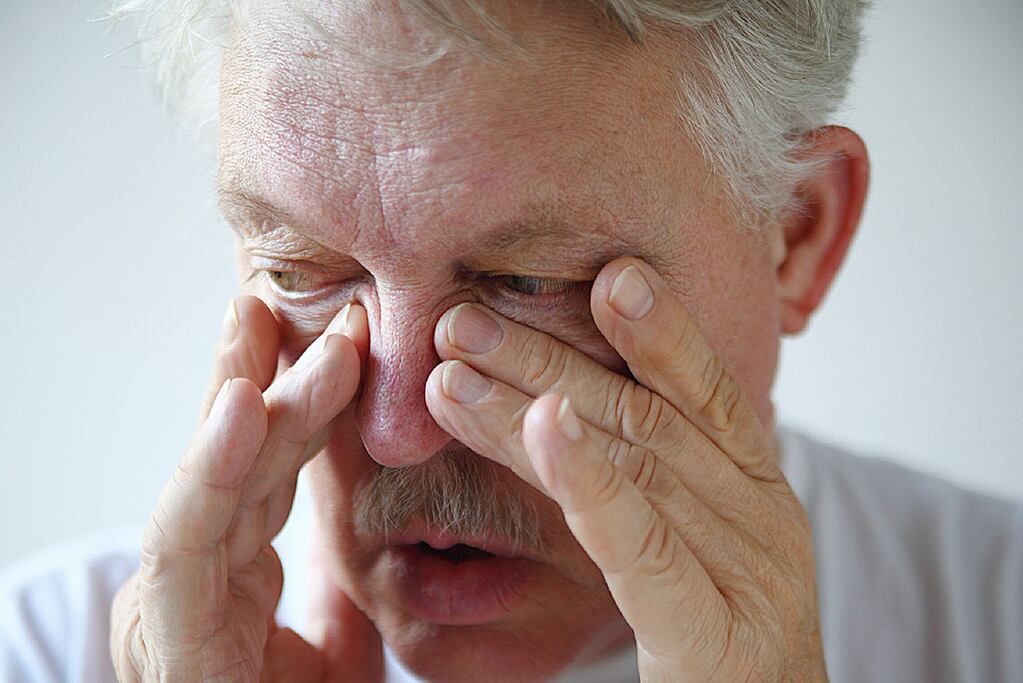 Congestión nasal, lagrimeo, estornudos, rinitis, entre otros, están a la orden del día. Foto: Sanatorio Allende