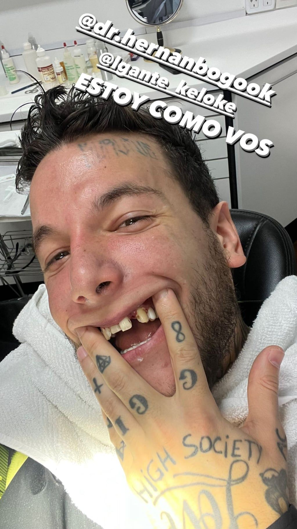 Alex Caniggia comparó su dentadura con la de L-Gante.