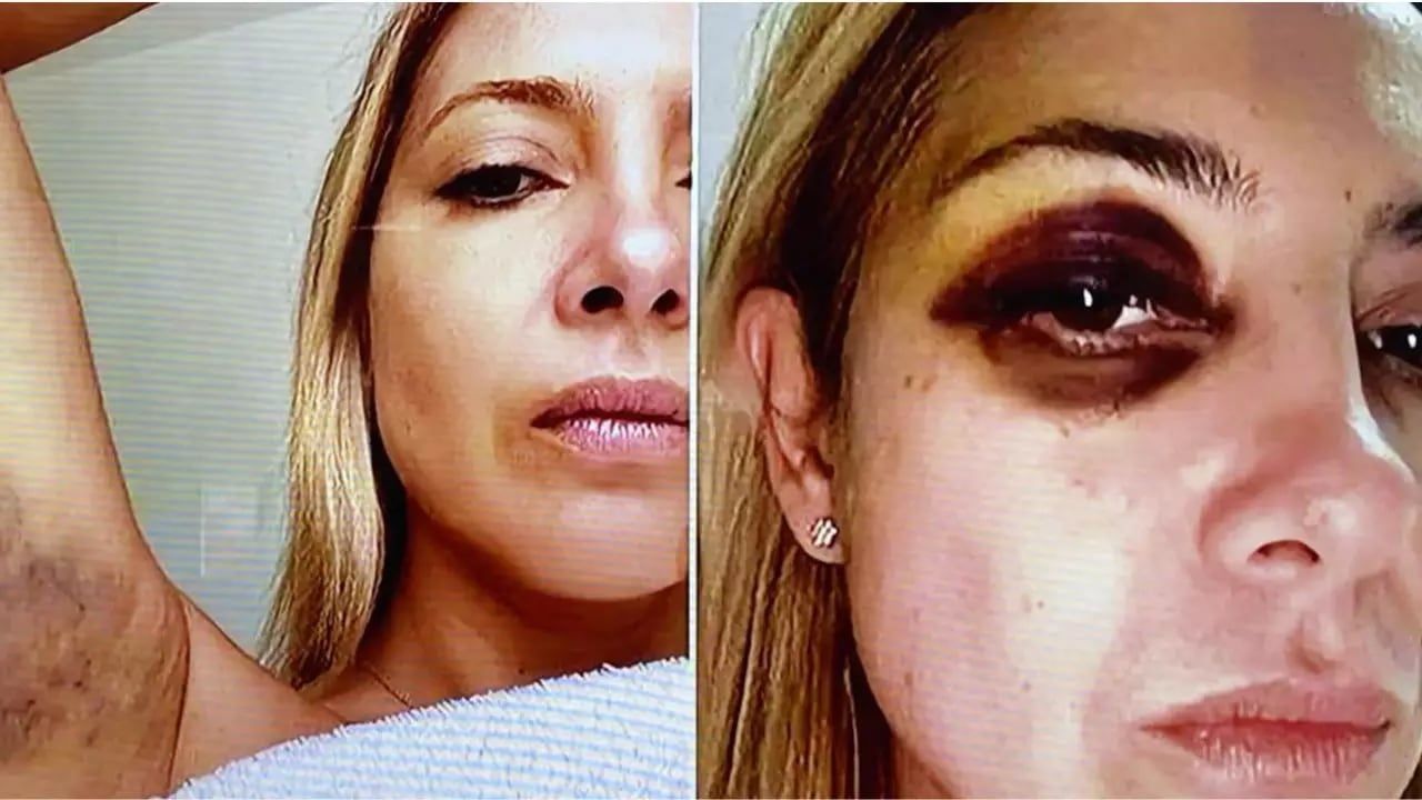 Las fotos de Fabiola Yañez golpeada.