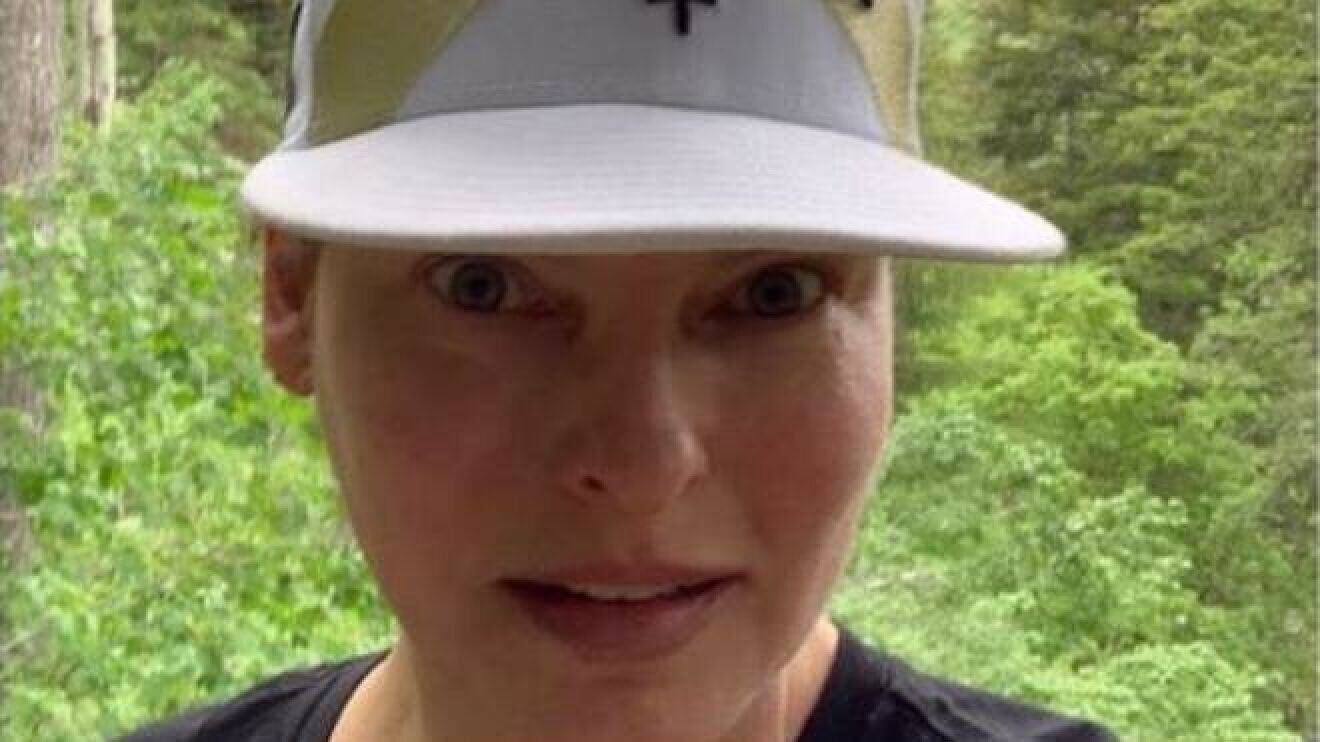 La modelo quedo desfigurada luego de un tratamiento médico