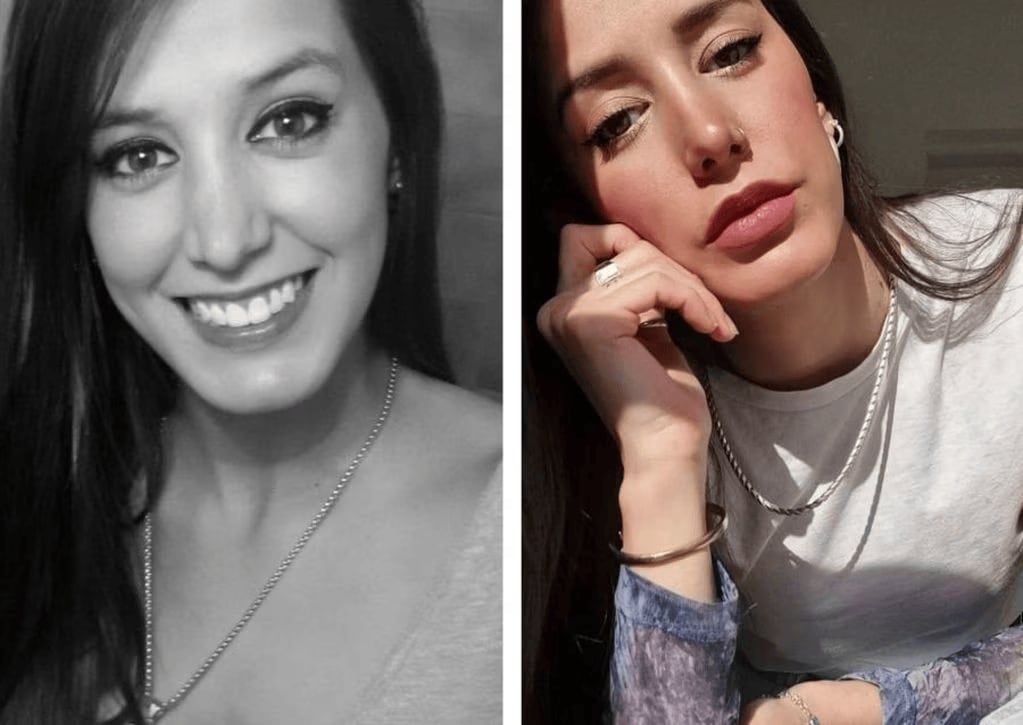 Así luce tras sus retoques estéticos, la ex Gran Hermano.