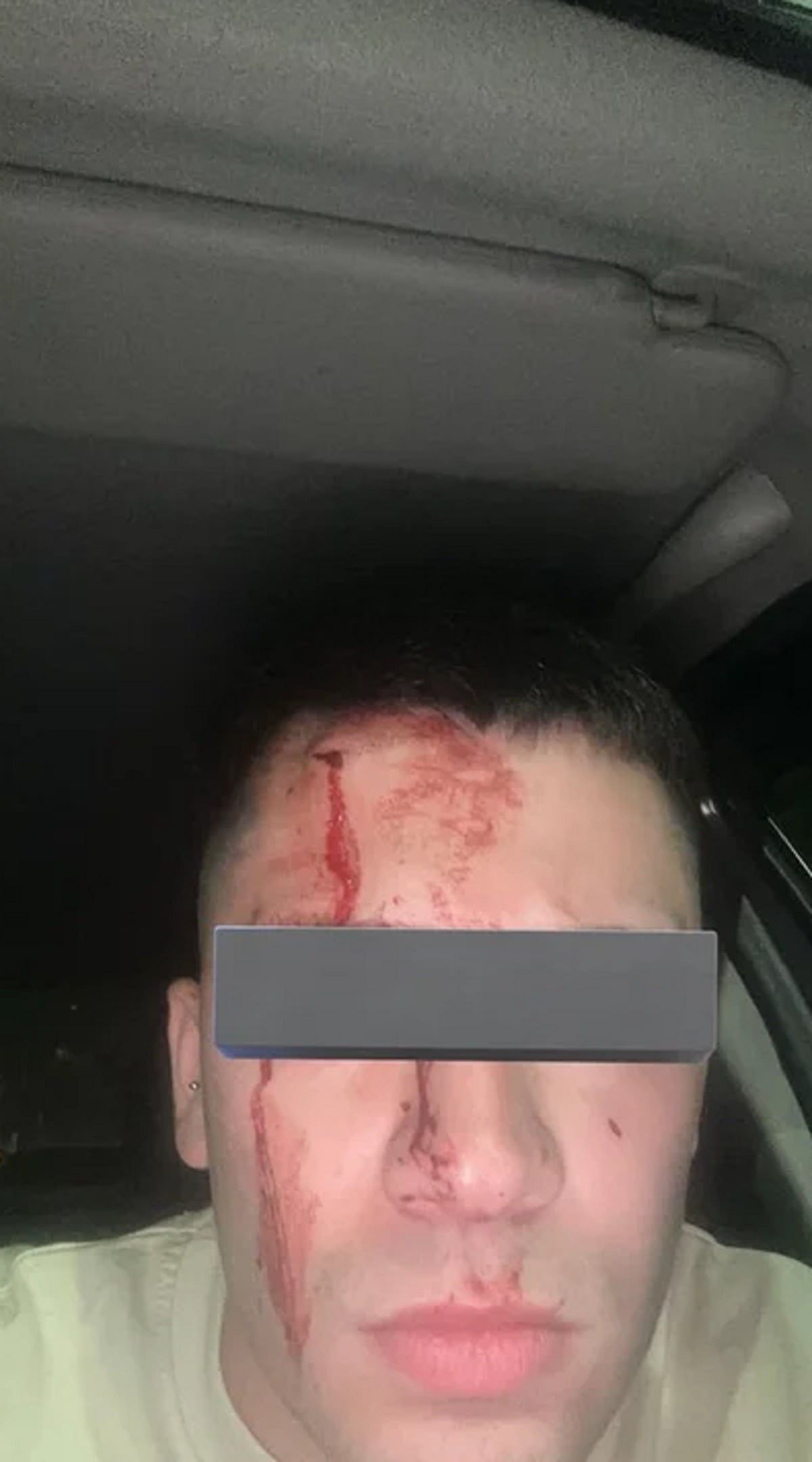 Así quedó el socio del rojo agredido por Marcone (Foto: NA)