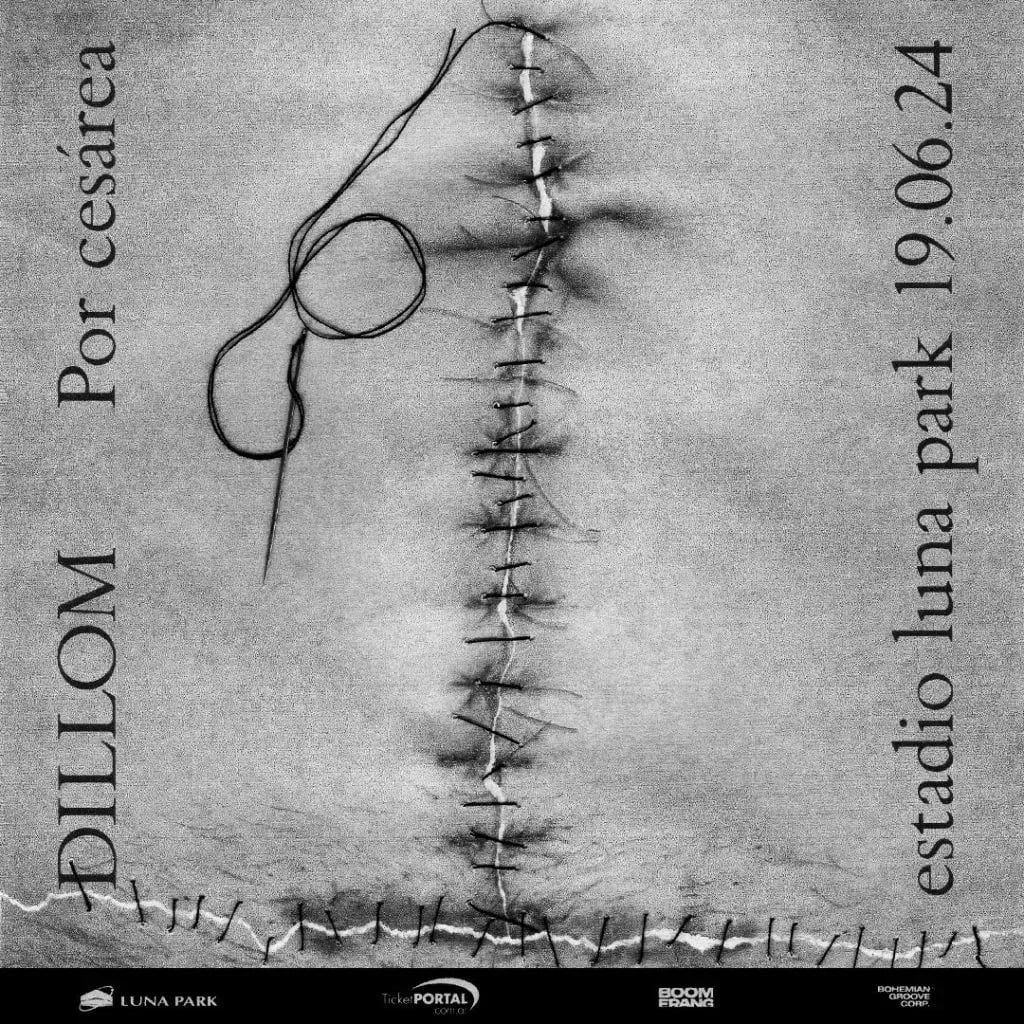 Nuevo recital de Dillom en el Luna Park