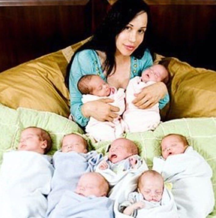 Los octillizos nacieron sanos.