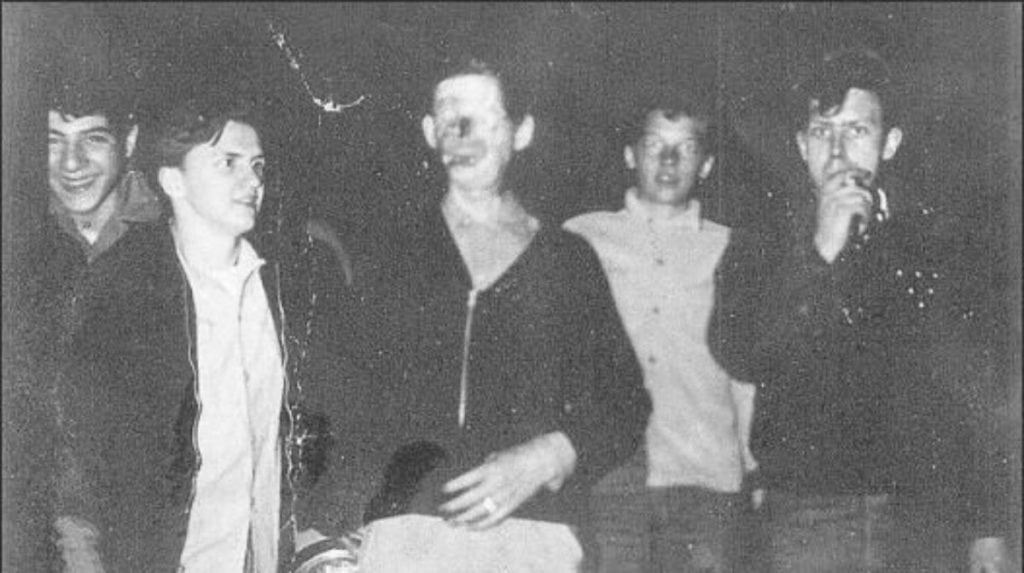 Un sujeto sufrió la desfiguración de su rostro y eso dio pie para el surgimiento de una tenebrosa leyenda.