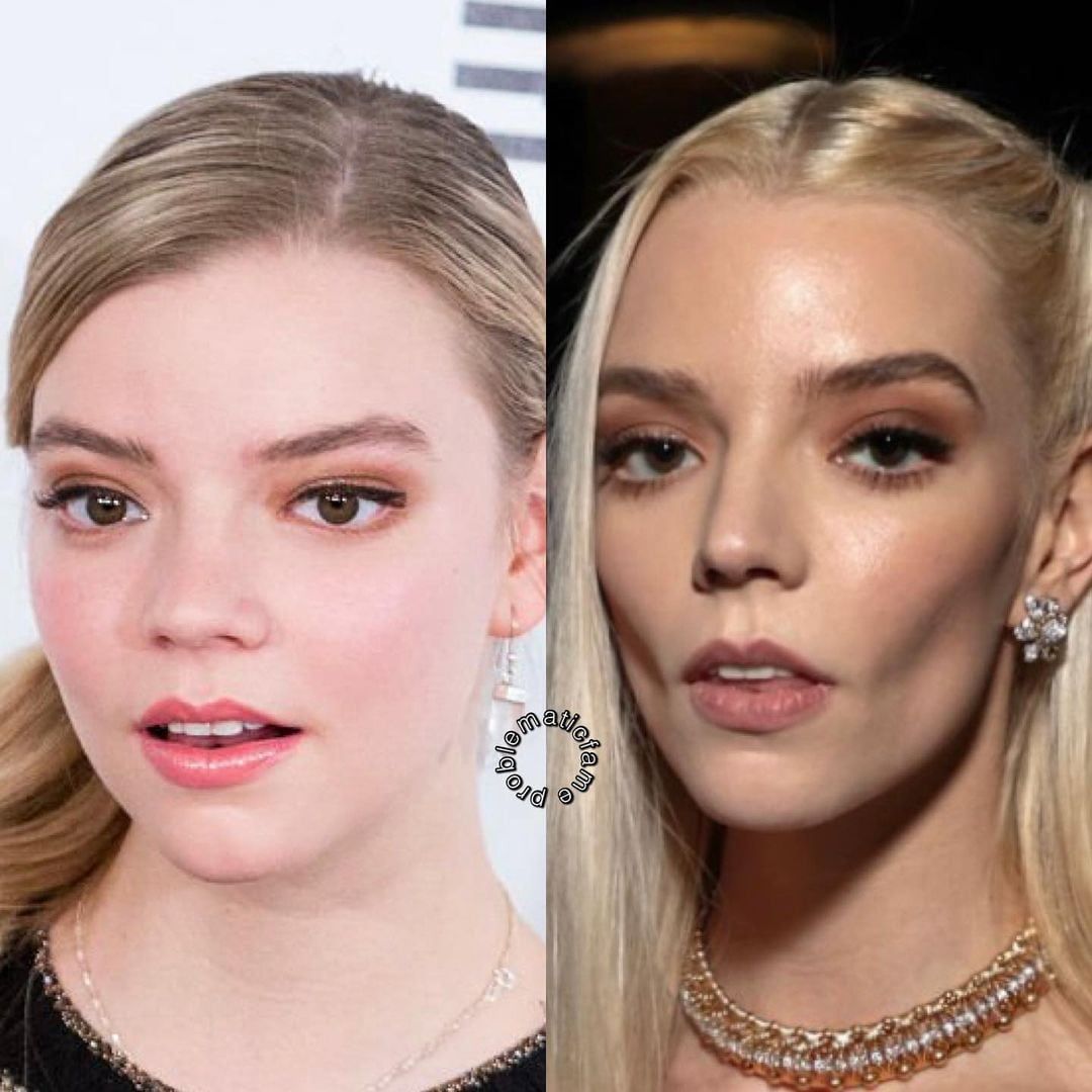 El antes y después de Anya Taylor-Joy