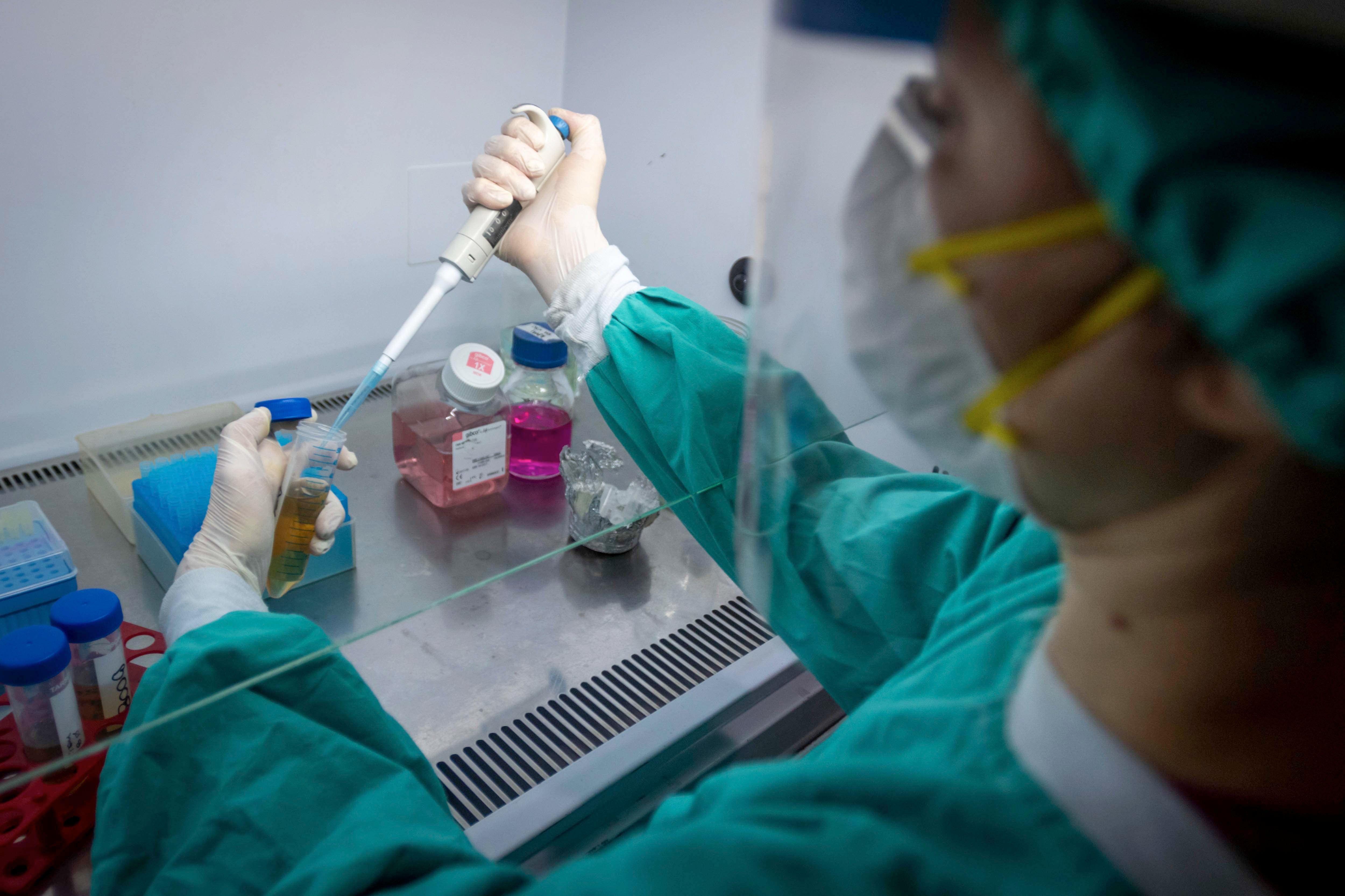 Los virus productores de hepatitis permanecen siendo el motivo de estudio e investigación de una gran parte de la comunidad científica en el mundo. 
Foto: Ignacio Blanco / Los Andes