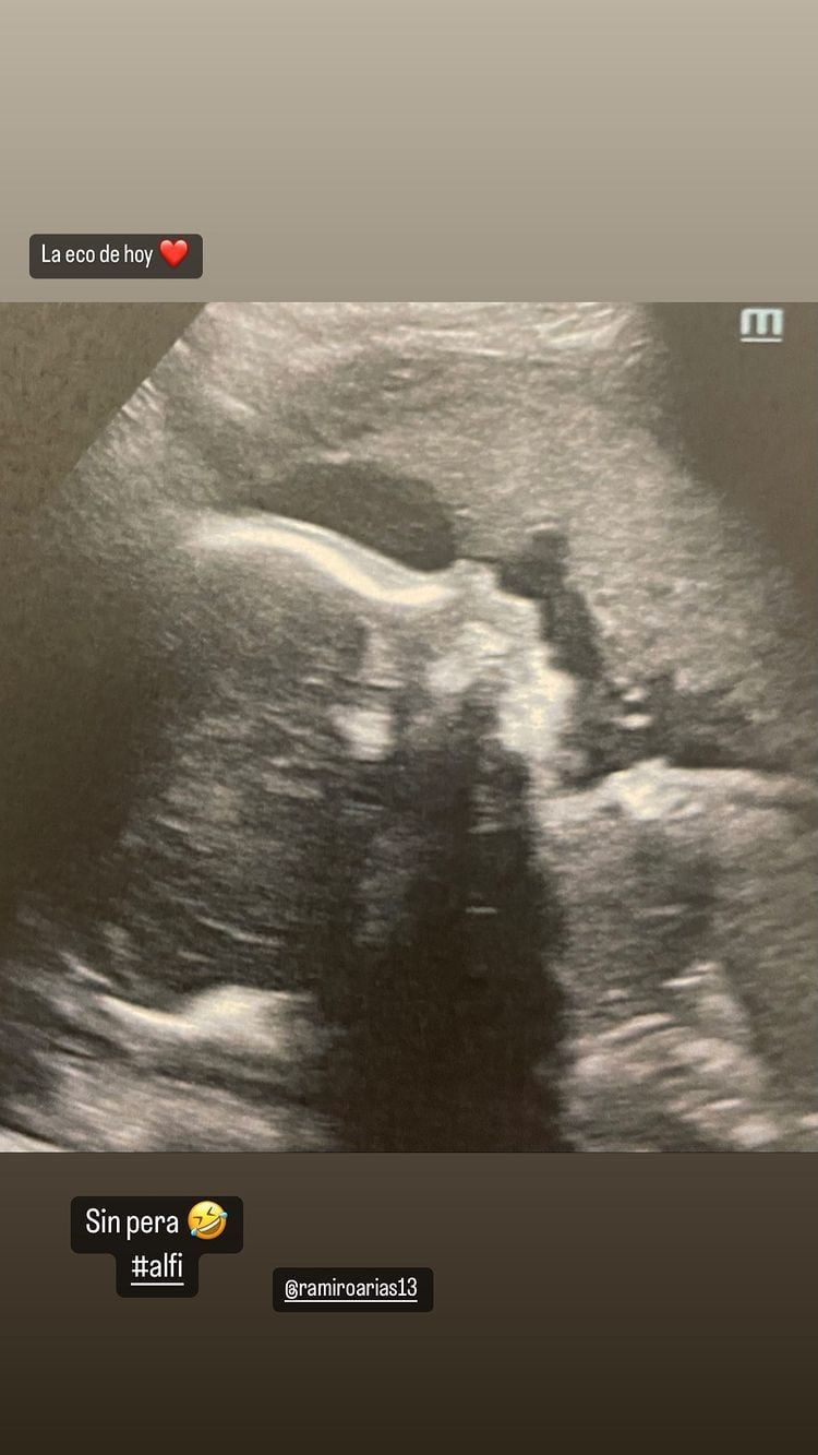 Noelia Marzol y el problema de salud que está cursando en pleno embarazo