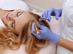 En los últimos años el plasma rico en plaquetas ha tenido gran repercusión en el tratamiento de algunas alopecias.