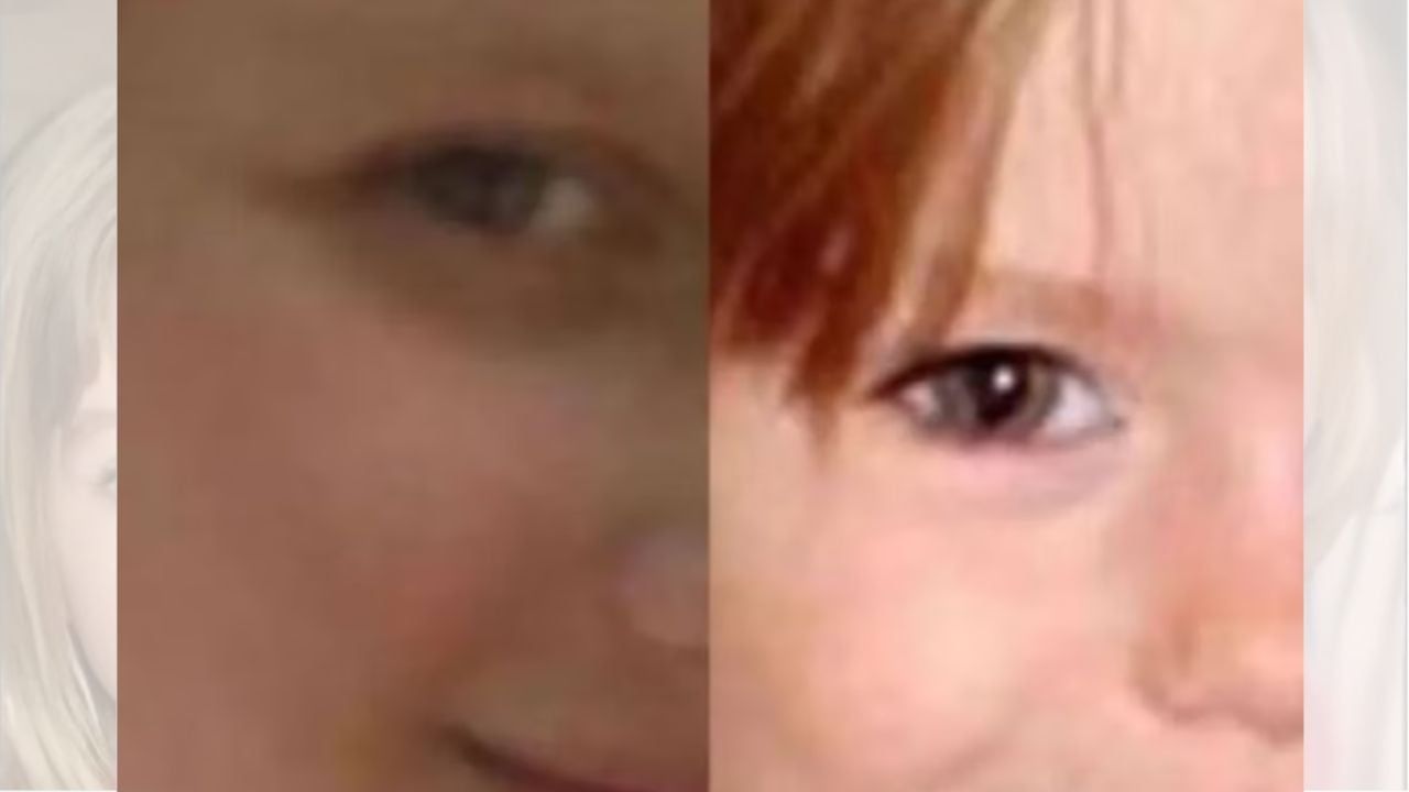 La joven comparó su ojo derecho con el de Madeleine.