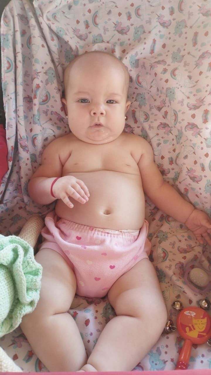Tiene 10 meses, nació con una enfermedad rara y espera que la obra social pague el tratamiento tras sentencia judicial. Foto: Gentileza Yanina Bressa