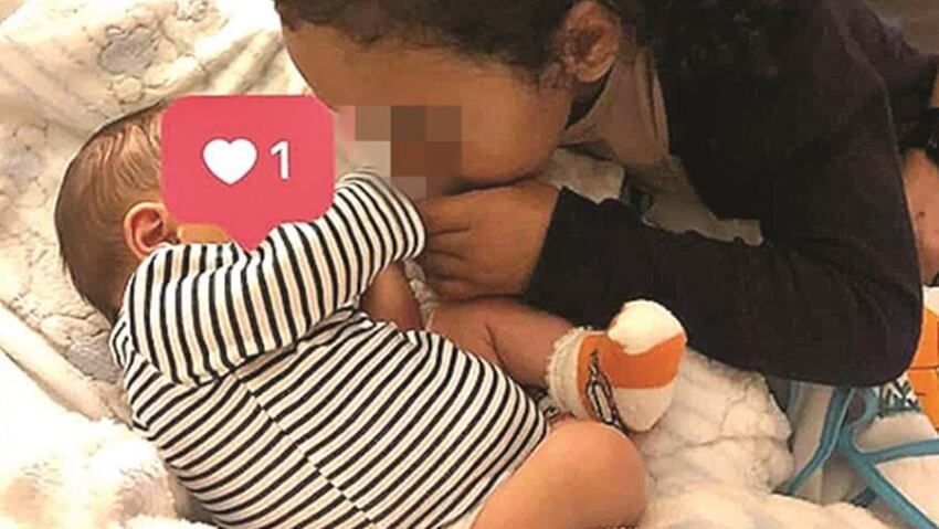 
    La imagen de el "bebé sin rostro". Foto: cm-tv.pt
   