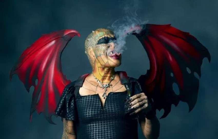 "Fui la quinta persona en el mundo en tener cuernos en el cráneo", asegura. | / Jam Press