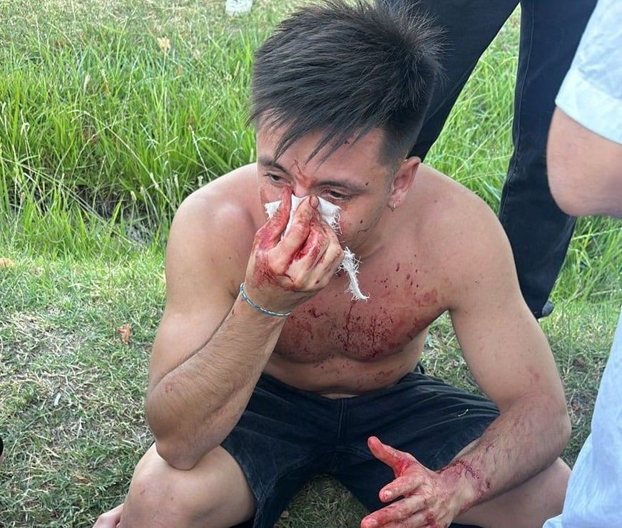 Mateo Di Bari el ingeniero agredido