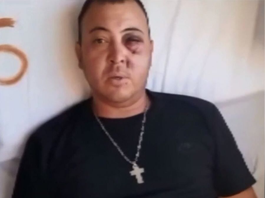 Rodrigo Arballo tiene la visión comprometida