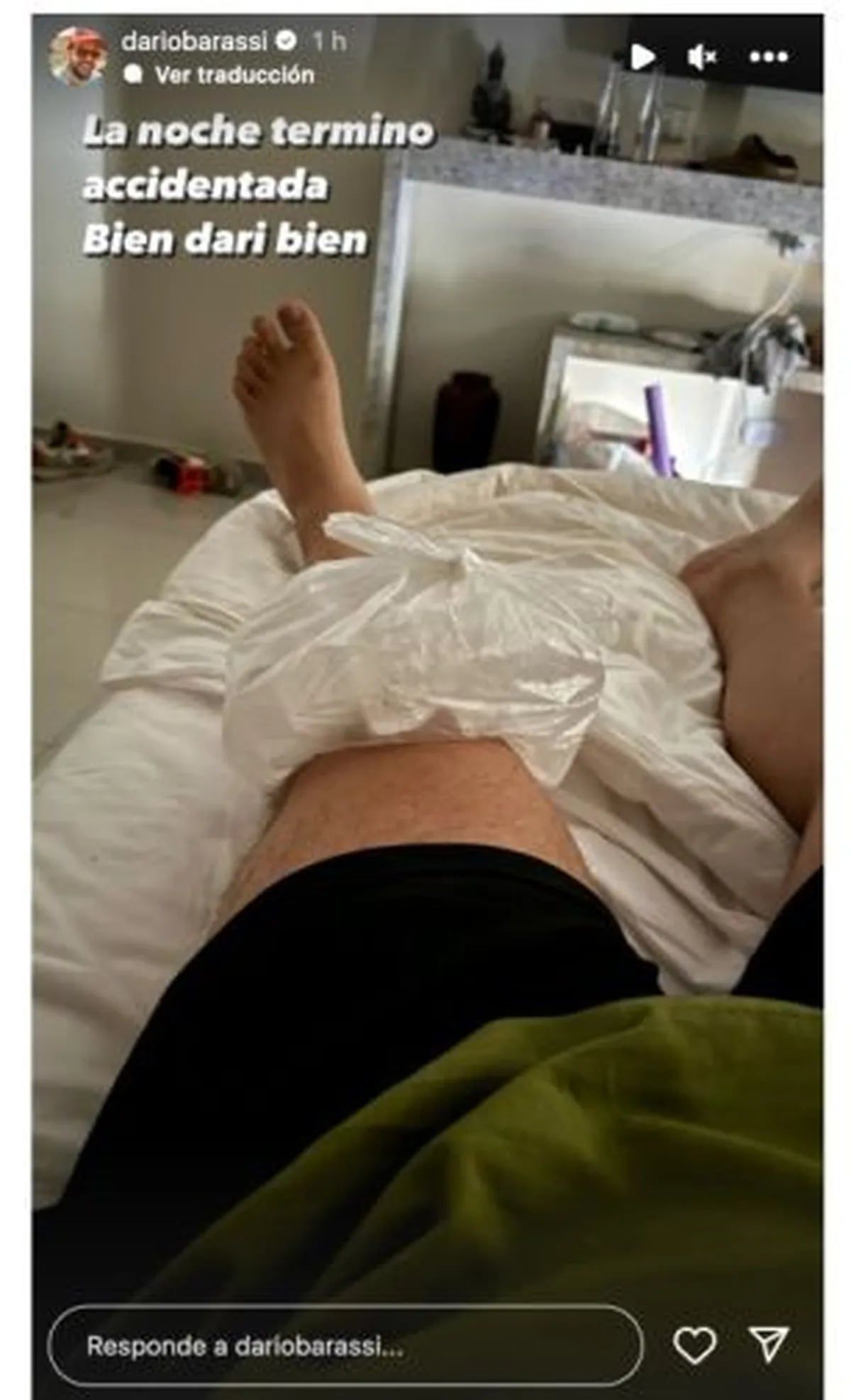 La Navidad accidentada de Darío Barassi. / Instagram