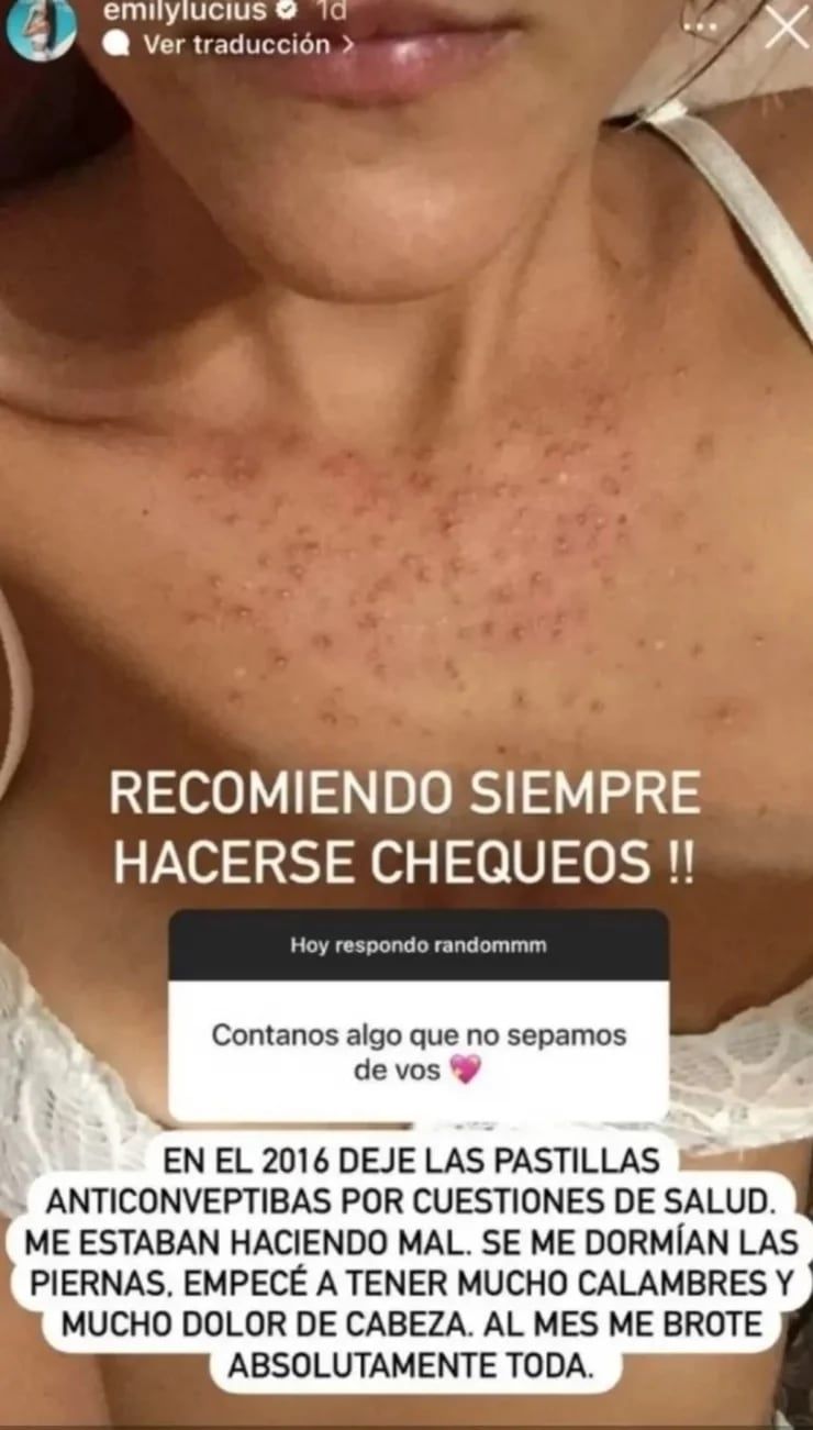 Emily Lucius totalmente brotada debido a las pastillas anticonceptivas