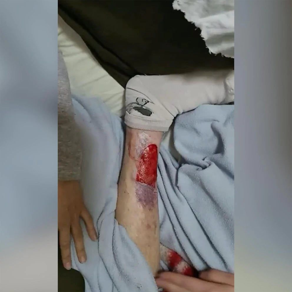 La mujer de 100 años, que ya no podía valerse por sí misma, fue golpeada y torturada por su cuidadora durante varias semanas -