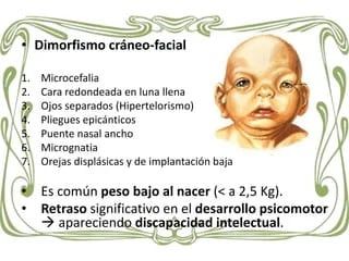 El síndrome de Cri Du Chat está causado por una alteración cromosómica.