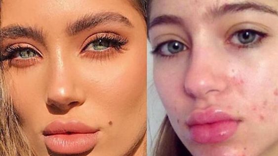 Una nueva ley prohíbe que los influencers y modelos utilicen filtros para borrar imperfecciones ya que transmite un mensaje erróneo de la realidad.