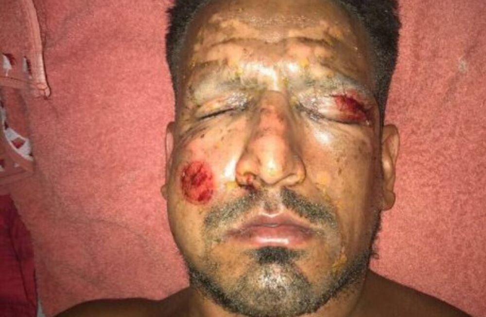 Viatri vuelve al fútbol tras el accidente con pirotecnia que lo dejó cinco meses sin jugar