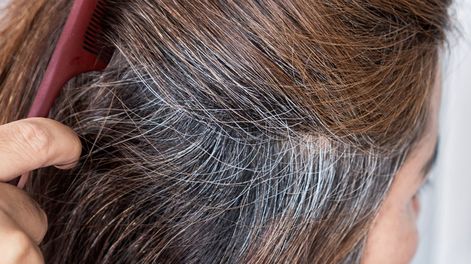 Los Andes | origen de las canas
