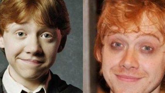 ¿Qué le pasó? Así luce hoy Rupert Grint