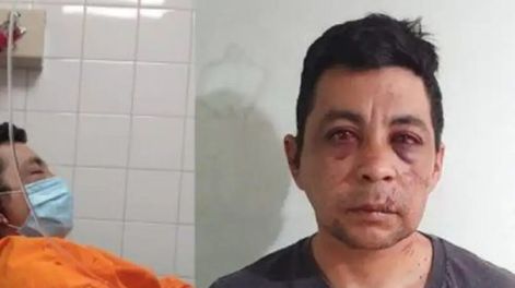 Murió Daniel Porro, el enfermero que había sido brutalmente golpeado por sus vecinos al haberse contagiado Covid-19. Archivo