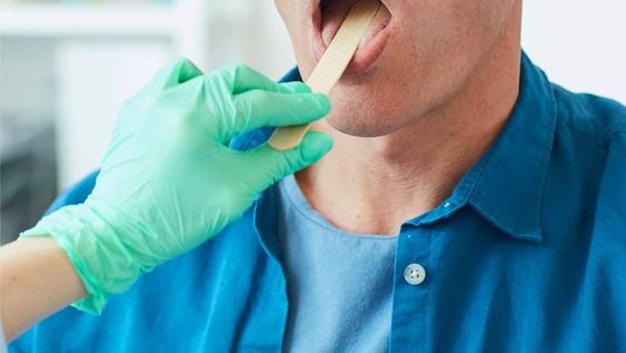 Es producido por varias conductas de riesgo, especialmente por fumar. Pero el sexo oral está teniendo que ver también en el aumento de casos, según especialistas.