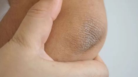 Cómo tener los codos suaves e hidratados solo con 2 ingredientes que tenés en tu cocina