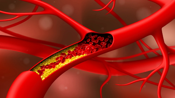 el alimento que limpia las arterias, combate el colesterol y mejora la memoria