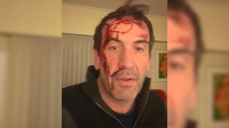 Violento asalto a un candidato libertario: Le gatillaron varias veces, pero el arma no se disparó