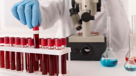 Bioquímicos advierten que faltarán insumos por el alto costo.