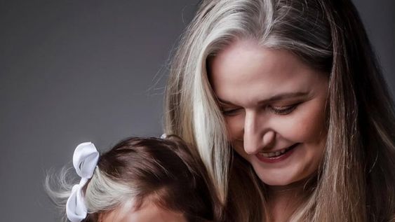 La pequeña nació con piebaldismo, una condición genética que hace que las áreas de la piel o el cabello parezcan más claras de lo habitual.