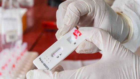 CIC de El Plumerillo, Las Heras, muy baja concurrencia en los centros de testeos Covid a causa del nuevo criterio epidemiologico para diagnosticar la infección. Solo se realizan hisopados con órden médica especifica, tambien a embarazadas, mayores de 60 años y personas con comobilidades. Foto: Mariana Villa / Los Andes