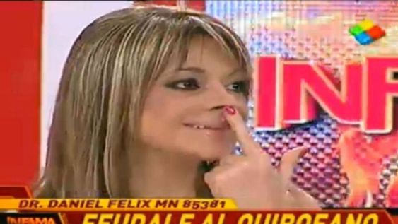 Marcela Feudale pasó por el quirófano y así quedó