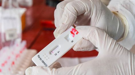 Aumentaron los casos de Covid-19 en Mendoza pero las cifras aún están dentro de lo normal. Foto: Archivo Los Andes