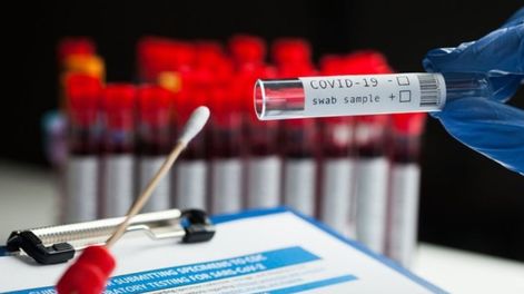 Los Andes | Ecuador es el tercer país en América con mayor tasa de letalidad por la pandemia.
