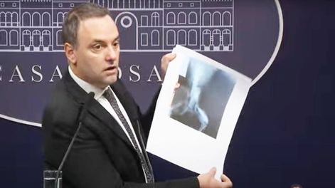 Adorni mostró la radiografía de un perro usada para obtener una pensión por invalidez.