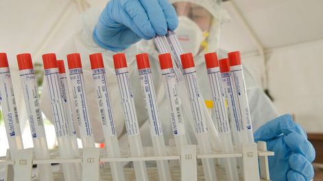 Testeos rapidos del Covid 19. Personal de la Salud realizan testeos en el Julio Le parchisopo test, enfermera, medicotiempo, distanciamiento social, clima, frio , calor, verano, primavera , fila, banco, centrico, coronavirus, covid19 , pandemia,