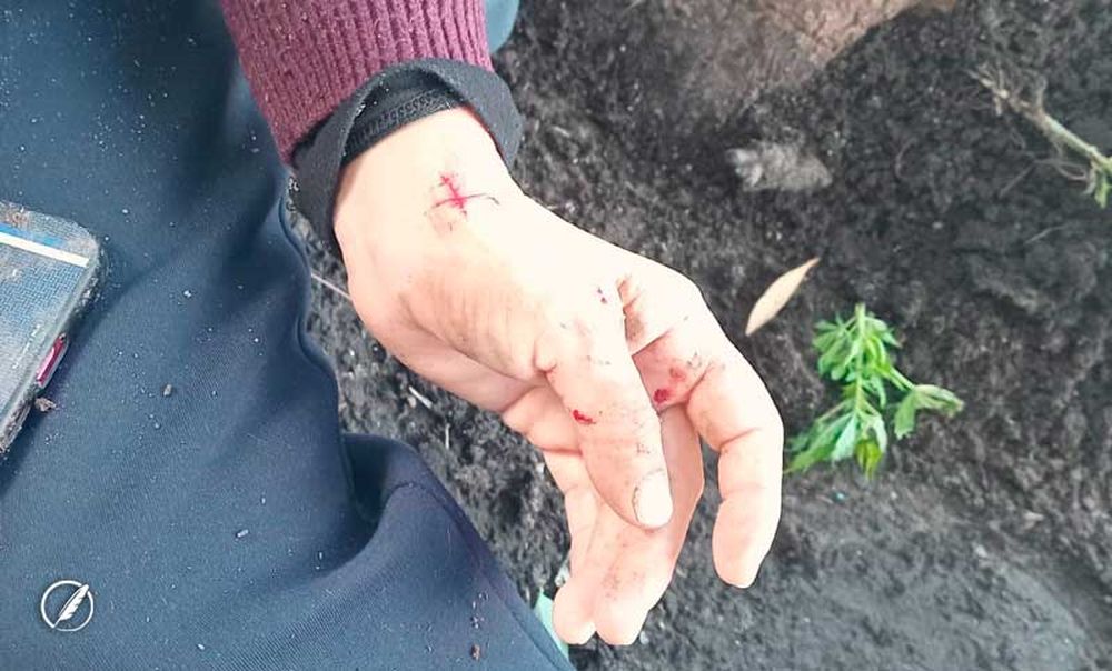 La mujer sufrió heridas en mano y hombro.