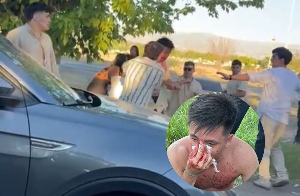 Rugbiers agredieron a un joven a la salida de una fiesta en Luján. Gentileza