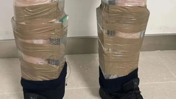 El hombre vestía una remera de mangas cortas y no llevaba abrigo. Pero las autoridades aeroportuarias notaron que la parte baja de su cuerpo se veía desproporcionada. Foto: Cnbeta