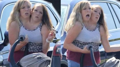 Las hermanas siamesas Abby y Brittany Hense.