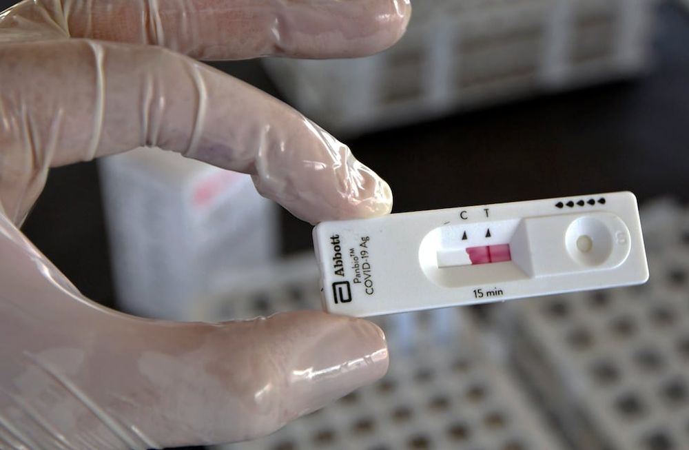 A nivel nacional, durante agosto se observó un incremento de 40% en las notificaciones. En Mendoza, las notificaciones semanales se triplicaron. | Foto: Orlando Pelichotti / Los Andes