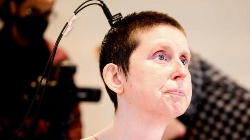 Ann, participante del estudio con un implante de inteligencia artificial.